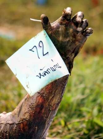 Photo: Numbered Arm and Hand of a Tsunami Victim
